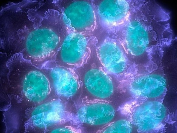 Mỹ lần đầu cấp phép ứng dụng công nghệ biến đổi gen trị ung thư