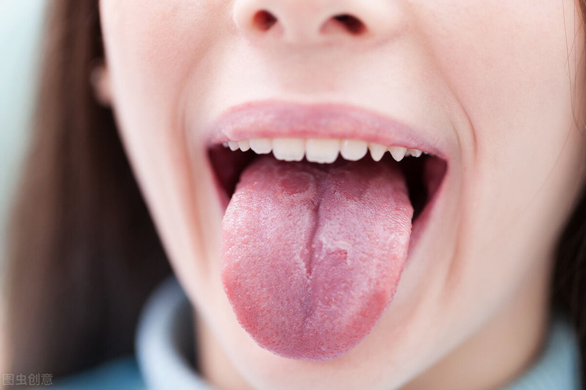 5 biểu hiện ở lưỡi cho thấy cơ thể đang có bệnh, nếu không có cái nào chứng tỏ bạn đang rất khỏe mạnh - Ảnh 1.
