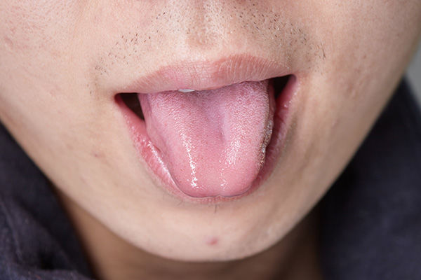 5 biểu hiện ở lưỡi cho thấy cơ thể đang có bệnh, nếu không có cái nào chứng tỏ bạn đang rất khỏe mạnh - Ảnh 3.