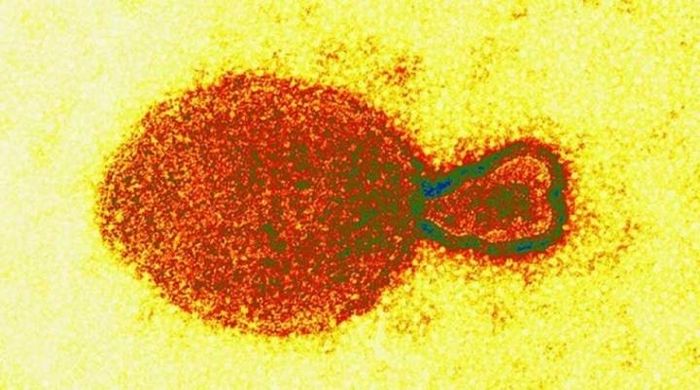 Hình ảnh hiển vi điện tử của virus HeV thuộc chi Henipavirus.