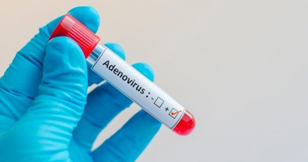 Khi nào nên xét nghiệm Adenovirus cho trẻ? - Ảnh 1.