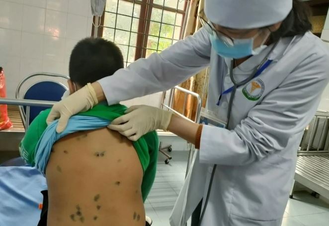 Bác sĩ khám và điều trị cho các học sinh mắc bệnh thuỷ đậu (ảnh Trung tâm Y tế TP. Bắc Kạn)