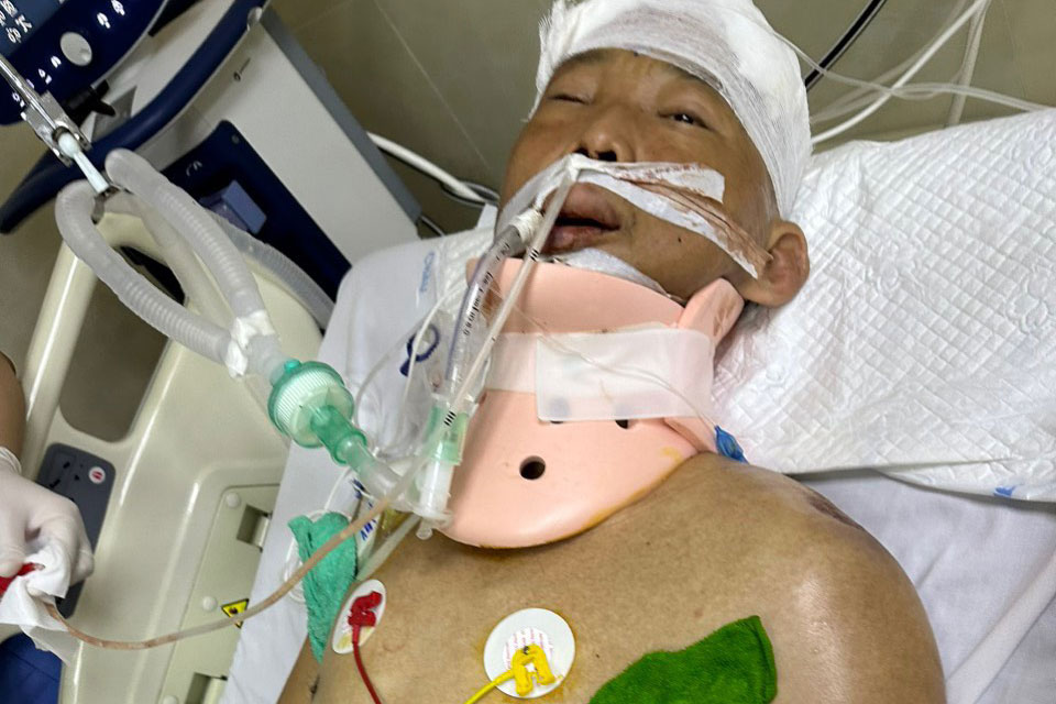 Công nhân vệ sinh môi trường Nguyễn Viết Hào nhập viện trong tình trạng bị chấn thương sọ não, gãy đốt sống cổ và gãy xương sườn... Ảnh: Urenco