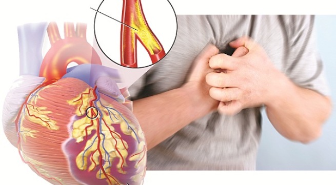 Việc phát hiện và điều trị sớm bệnh tim mạch là chìa khóa để duy trì sức khỏe và tránh các biến chứng nguy hiểm. Ảnh minh họa