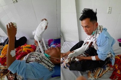 Kon Tum: Nhân viên bảo vệ rừng bị chém nhập viện