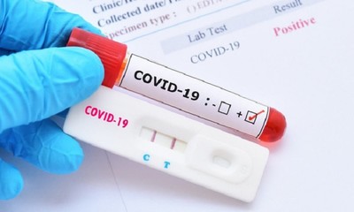 16 loại test nhanh kháng nguyên SARS-CoV-2 được Bộ Y tế cấp phép