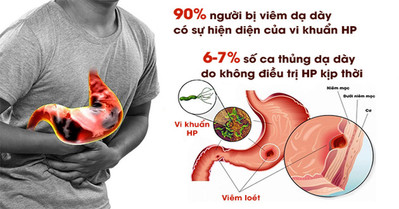 Thực phẩm ‘thần dược’ kiềm chế vi khuẩn gây ung thư dạ dày