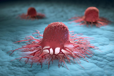 "Cân" tế bào ung thư để lựa chọn thuốc điều trị phù hợp