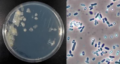 Azotobacter vinelandii: Vi khuẩn thay cho phân bón hoá học, bảo vệ môi trường