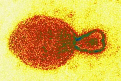 Virus Henipavirus phát hiện ở Trung Quốc nguy hiểm thế nào?