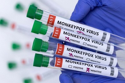 Mỹ đầu tư 11 triệu USD sản xuất vaccine đậu mùa khỉ  
