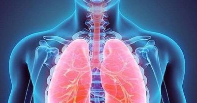 Mùa xuân cảnh giác với viêm phổi người lớn