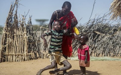 Nạn đói khiến trên 8,3 triệu người cần hỗ trợ nhân đạo ở Somalia