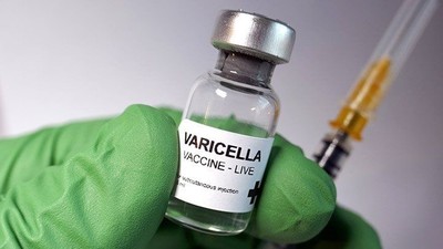 25 năm đẩy lùi bệnh thủy đậu bằng vaccine Varicella