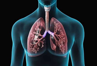 Các giai đoạn của lao phổi và phương pháp điều trị bệnh hiệu quả