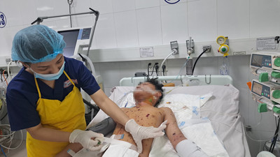 Đà Nẵng: Thiếu niên bị vỡ nát nhiều đoạn ruột, dập nát tay do chơi pháo
