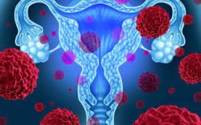 Tiêm ngừa ung thư tử cung để bảo vệ sức khỏe phụ nữ