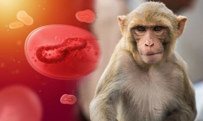 Cà Mau có trường hợp nghi mắc đậu mùa khỉ đầu tiên